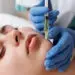 Face & Lip Volume Enhancement